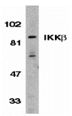 benchmark-antibodies_anti-ikkbeta_antibody_4247_1.jpg