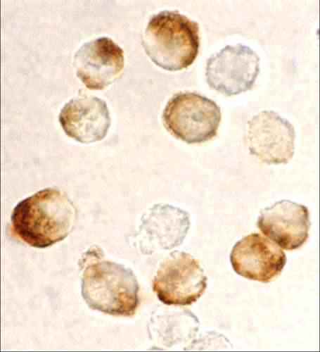 benchmark-antibodies_anti-ikkbeta_antibody_4247_2.jpg