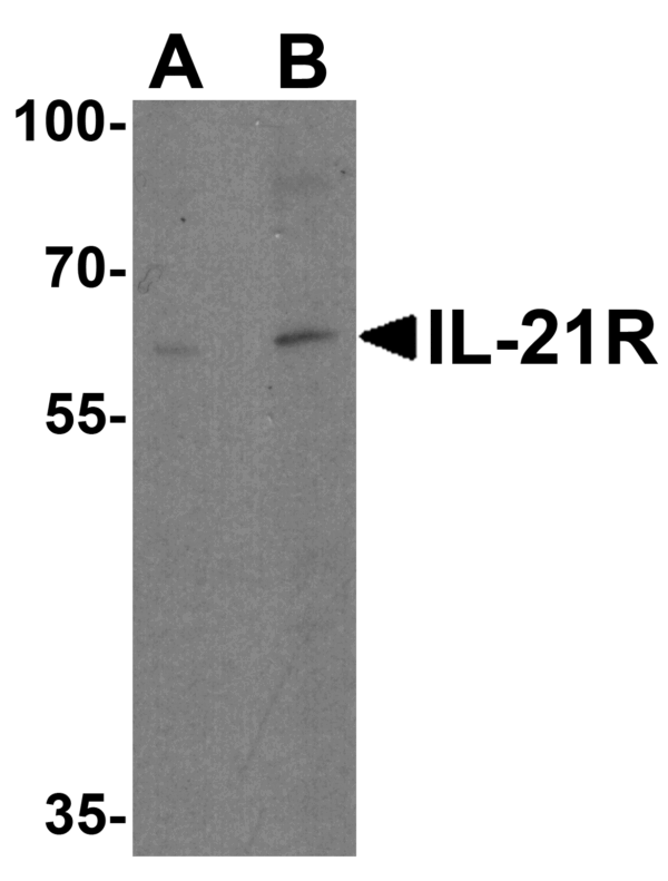 Western blot rabbit anti il 21r ed polyclonal antibody 6790