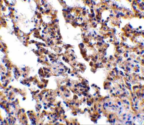 IHC rabbit anti il 21r ed polyclonal antibody 6790