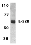 benchmark-antibodies_anti-interleukin-22_receptor_il-22r_ct_antibody_51