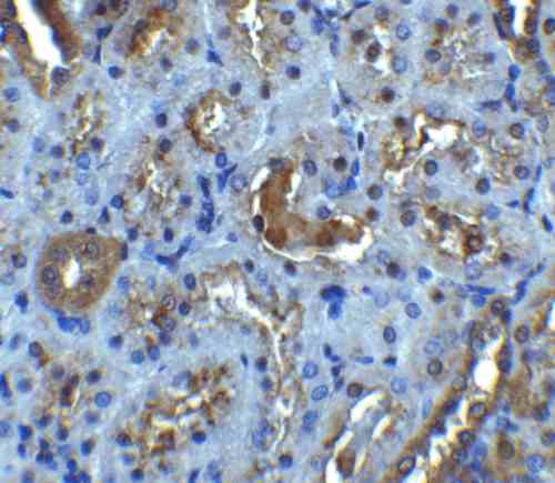 IHC rabbit anti il 22r nt polyclonal antibody 8937