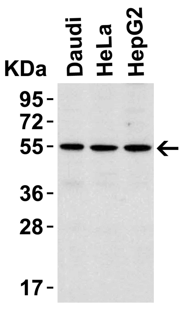 Western blot rabbit anti irak 4 polyclonal antibody 8508