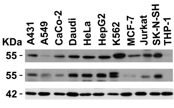 Western blot rabbit anti irak 4 polyclonal antibody 8508