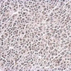IHC mouse anti mitosin monoclonal antibody 14c10 2862