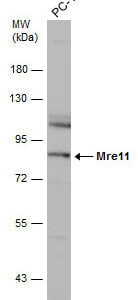 Western blot mouse anti mre11 monoclonal antibody 12d7 9138