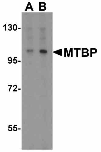 benchmark-antibodies_anti-mtbp_antibody_9173_1.gif