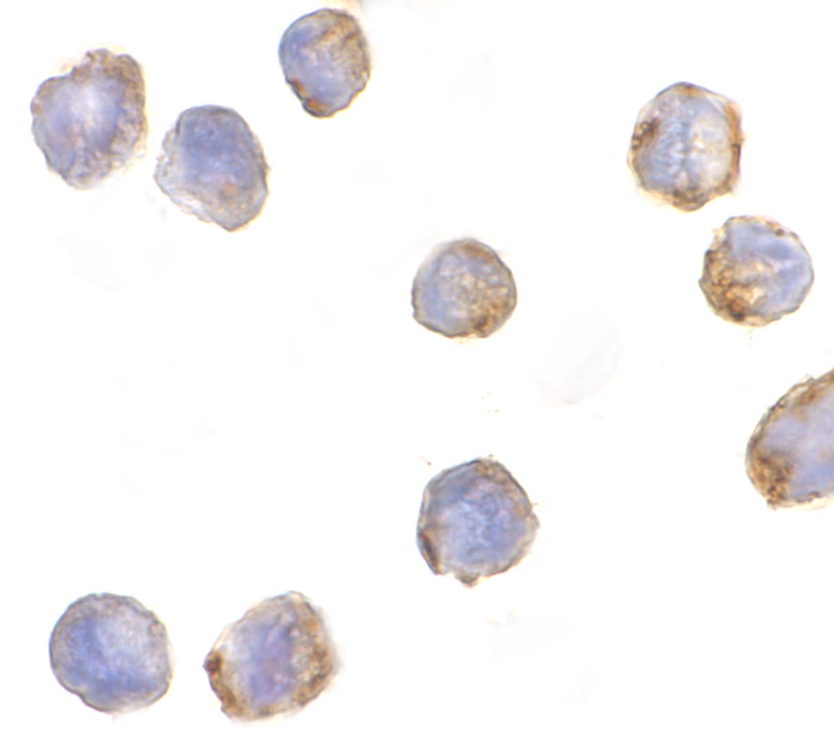 benchmark-antibodies_anti-mtbp_antibody_9173_2.jpg