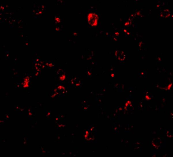 ICC/IF rabbit anti mtbp polyclonal antibody 9173