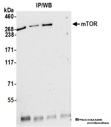 benchmark-antibodies_anti-mtor_antibody_5674_1.jpg
