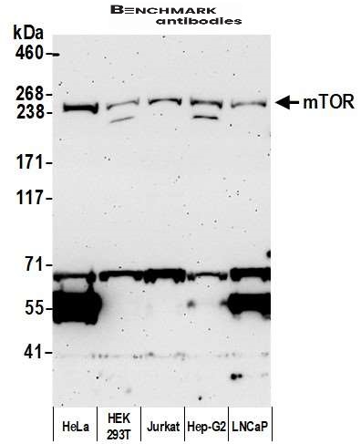 benchmark-antibodies_anti-mtor_antibody_5674_2.jpg