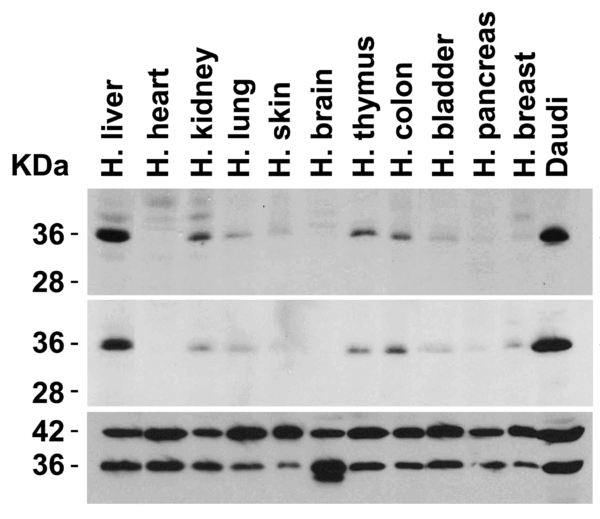 Western blot rabbit anti myd88 in polyclonal antibody 5407