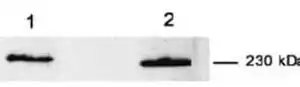 Western blot mouse anti myoferlin monoclonal antibody 7d2 2343