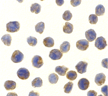 benchmark-antibodies_anti-nak-tbk1_ct_antibody_4716_1.jpg