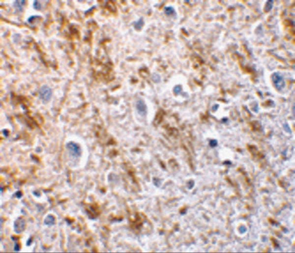 IHC rabbit anti neurturin polyclonal antibody 6199