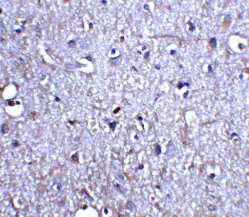 IHC rabbit anti neurturin polyclonal antibody 6199