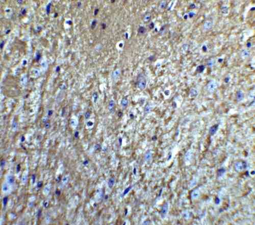 IHC rabbit anti neurturin polyclonal antibody 6199