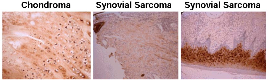 benchmark-antibodies_anti-osteocalcin_antibody_2273_1.jpg