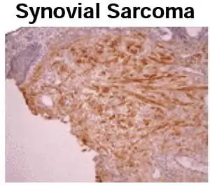 IHC mouse anti bovine osteocalcin monoclonal antibody ocg4 5454