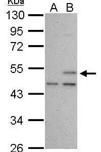 Western blot mouse anti p53 monoclonal antibody 240 5777