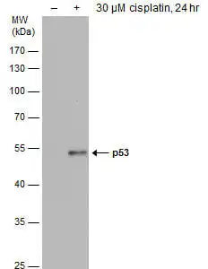 Western blot mouse anti p53 monoclonal antibody d01 8319