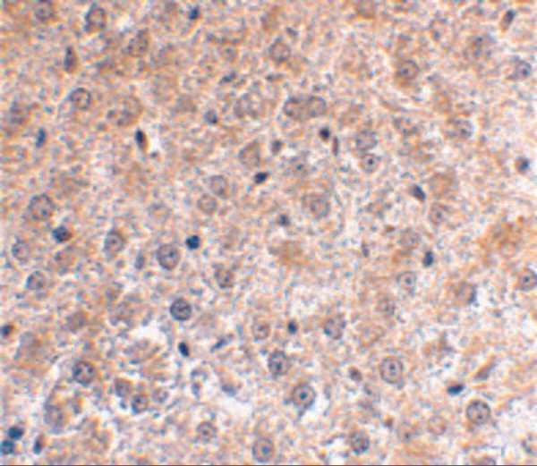 IHC rabbit anti p53dinp1 polyclonal antibody 5900