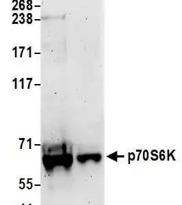 Western blot rabbit anti p70s6k kinase polyclonal antibody 8413