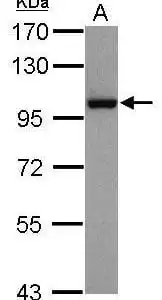 Western blot mouse anti p95 monoclonal antibody 1d7 1319