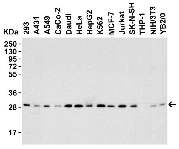 Western blot rabbit anti phap i ct polyclonal antibody 6528