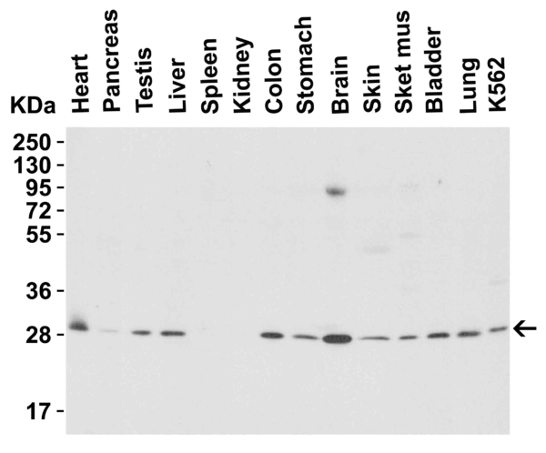 Western blot rabbit anti phap i ct polyclonal antibody 6528