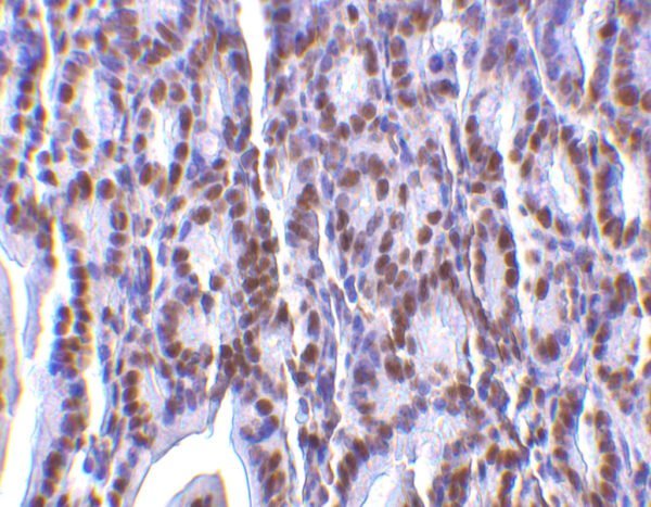 IHC rabbit anti phap i ct polyclonal antibody 6528