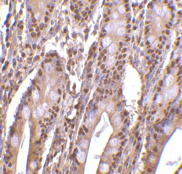 IHC rabbit anti phap iii polyclonal antibody 8922