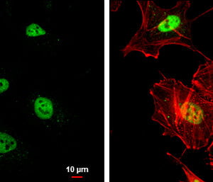 ICC/IF mouse anti rad50 monoclonal antibody 2c6 6741