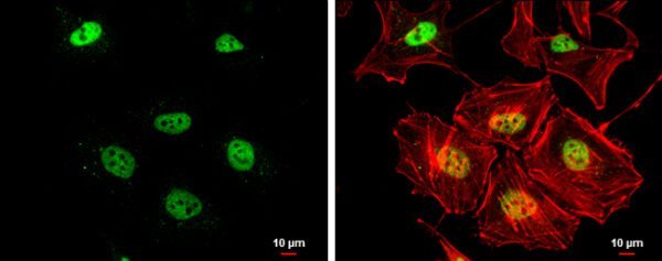 ICC/IF mouse anti rad50 monoclonal antibody 2c6 6741