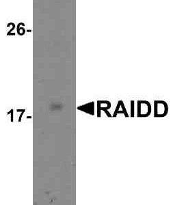 Western blot rabbit anti raidd ct polyclonal antibody 8020