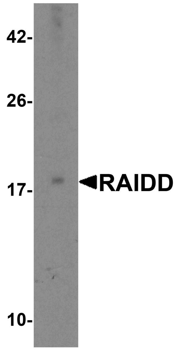 Western blot rabbit anti raidd ct polyclonal antibody 8020