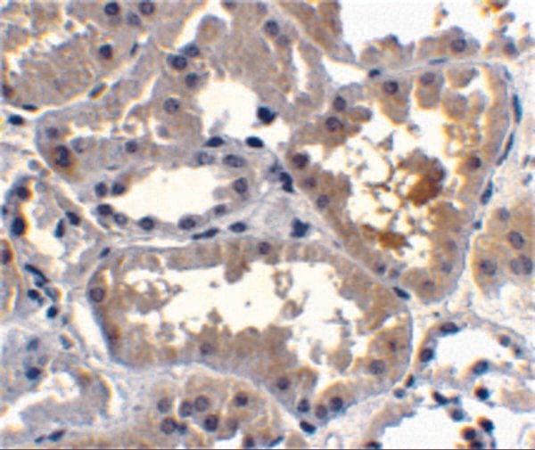 IHC rabbit anti raidd ct polyclonal antibody 8020