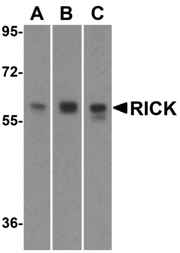 Western blot rabbit anti rick nt polyclonal antibody 5300