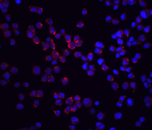 ICC/IF rabbit anti rick nt polyclonal antibody 5300