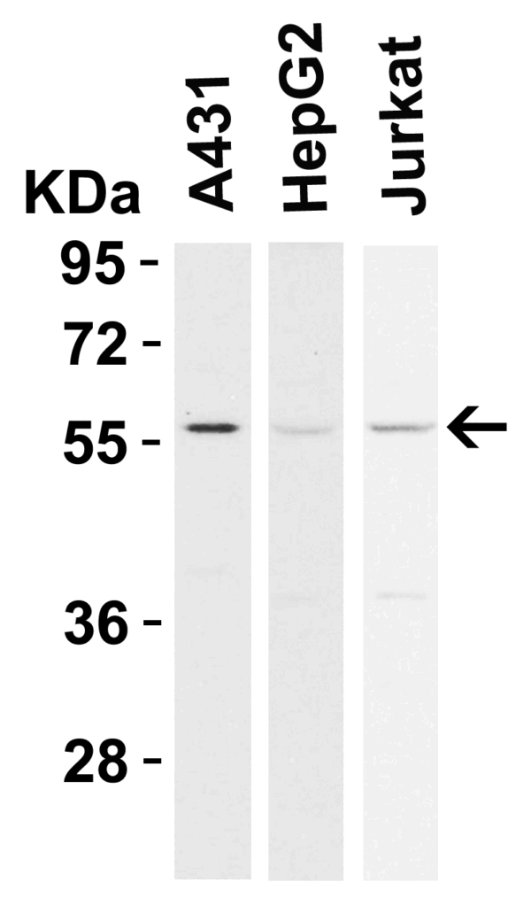 Western blot rabbit anti rip3 polyclonal antibody 3801