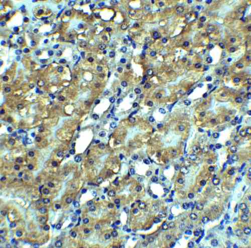 IHC rabbit anti rip3 polyclonal antibody 3801