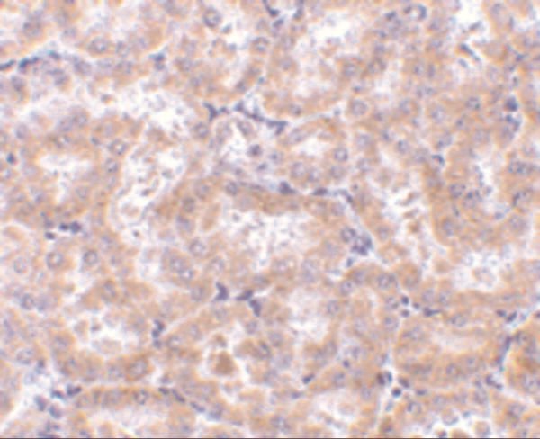 IHC rabbit anti rip3 polyclonal antibody 3801