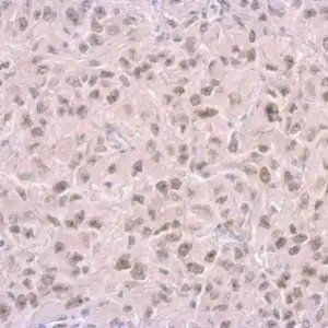 IHC mouse anti rpa14 monoclonal antibody 11 1 9765