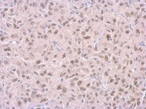 benchmark-antibodies_anti-rpa14_antibody_9765_1.jpg