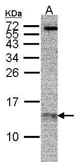 benchmark-antibodies_anti-rpa14_antibody_9765_3.jpg