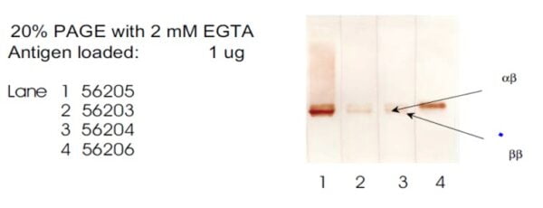 Western blot mouse anti s 100 monoclonal antibody 8b10 8253