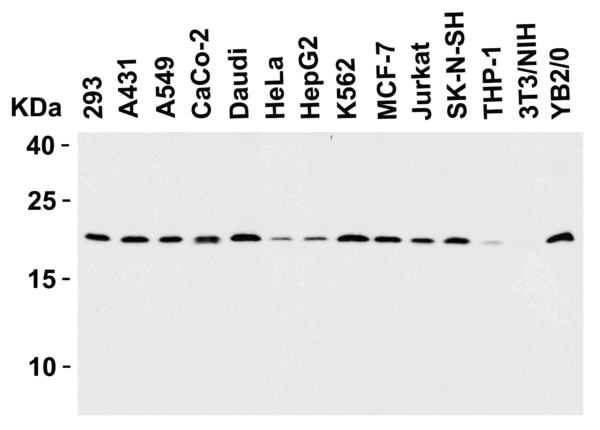 Western blot rabbit anti smac ct polyclonal antibody 4798