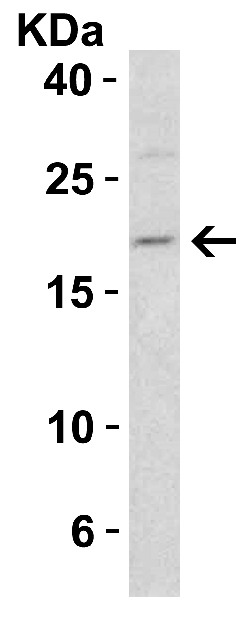 benchmark-antibodies_anti-smac_ct_antibody_4798_4.gif