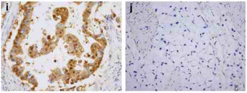 benchmark-antibodies_anti-smac_ct_antibody_4798_7.gif