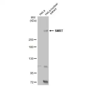 Western blot mouse anti smrt monoclonal antibody h7 7889